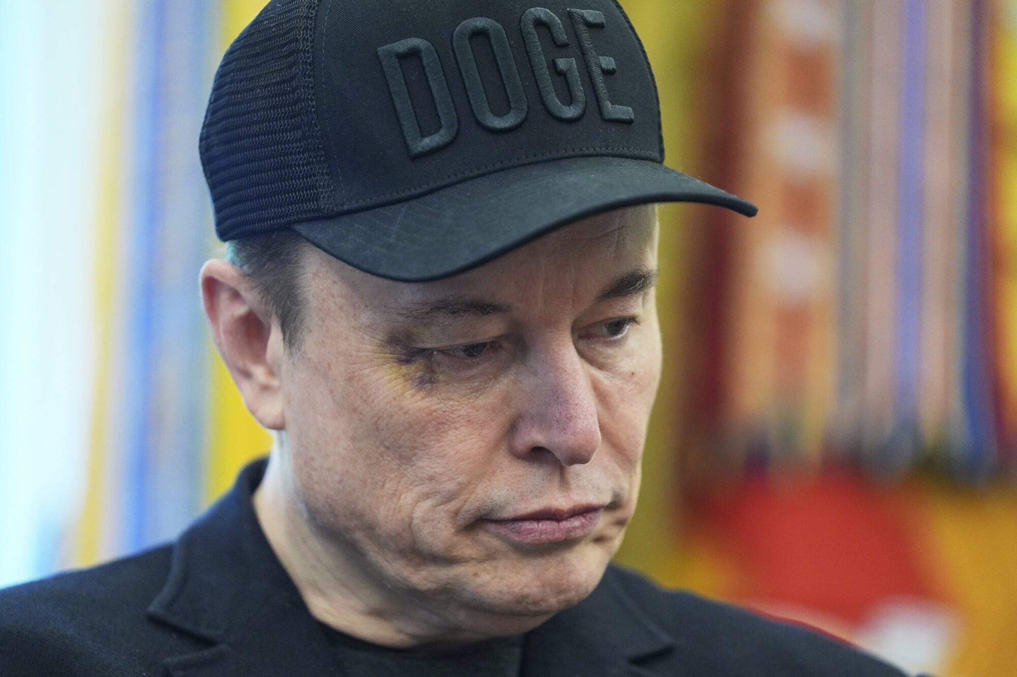 El sospechoso ojo morado de Elon Musk en su despedida del DOGE en la Casa Blanca: “Fue un golpe”​