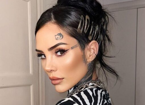 Cande Tinelli sufrió un accidente y debió ser operada de urgencia